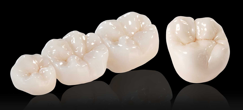 zirconium crowns